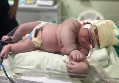 ‘Bebê Gigante’ nasce com mais de 7 kg em maternidade de Parintins