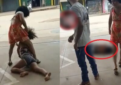 Mulher fica com rosto deformado após ser atacada por usuária de drogas; vídeo