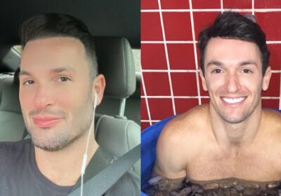 Irreconhecível! Diego Hypolito faz harmonização facial; veja antes e depois