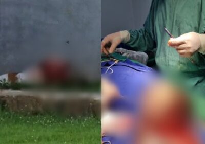 Criança é atacada por pitbulls e sobrevive após passar por cirurgia; cenas fortes!