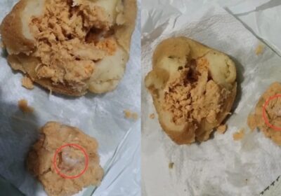 Mulher leva susto após encontrar dente humano em recheio de coxinha