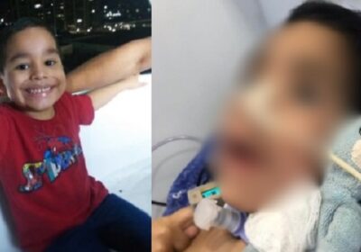 Família de menino agredido faz vaquinha em Manaus; pai e madrasta são suspeitos