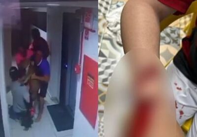 VÍDEO: Pitbull escapa de apartamento e ataca criança em condomínio