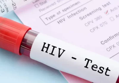 Pesquisa na Holanda pode ter descoberto a cura para o HIV