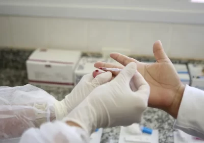 Fundação oferta testagem gratuita para hepatites virais, sífilis e HIV em Manaus