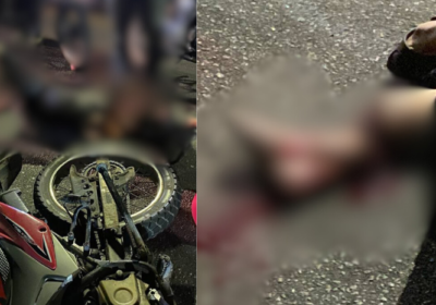 Motociclista fica com fratura exposta ao ser atingido por carro em Manaus