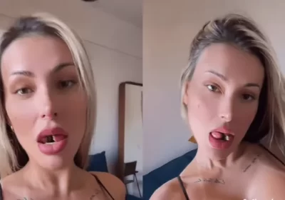 Andressa Urach baba para seguidores ao mostrar língua: “Ainda dói”