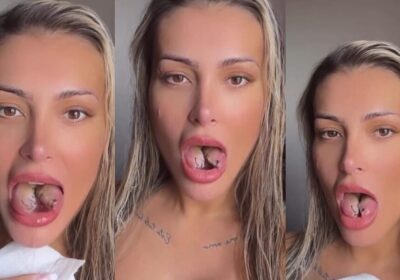 Após sentir muita dor, Andressa Urach faz novo procedimento na língua bifurcada