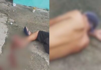 VÍDEO: Homem perde parte do pé após pisar em catolé jogado por crianças em Manaus